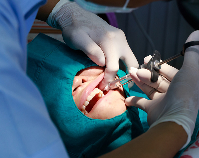 Инфекционный эндокардит после инвазивных стоматологических процедур 