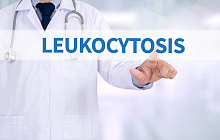 Лейкоцитоз, ассоциированный с терапией глюкокортикостероидами
