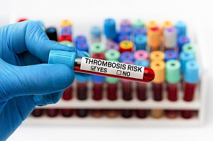 Липидснижающая терапия и риск венозных тромбоэмболий