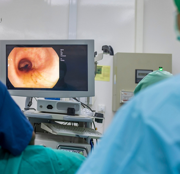 Риск кровотечений и тромбоэмболических событий после колоноскопии в зависимости от сроков возобновления антикоагулянтной терапии