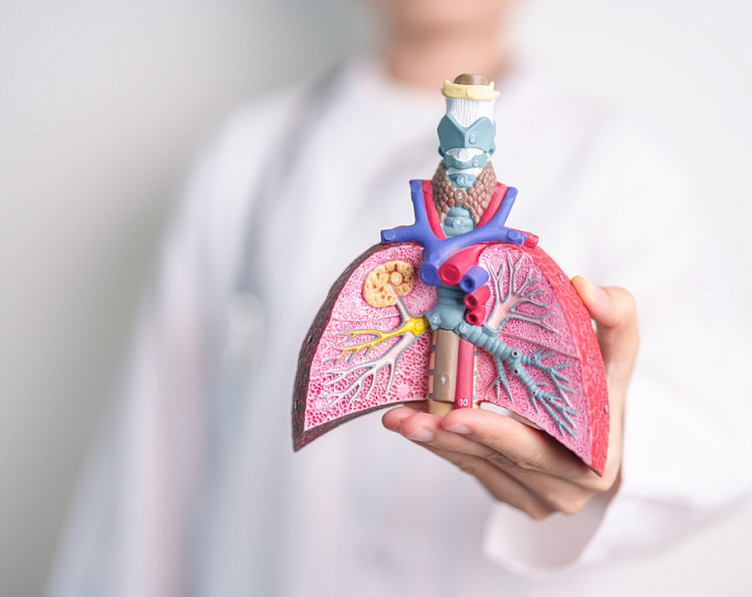 Влияние антибиотикотерапии на заболеваемость раком легких при идиопатическом легочном фиброзе