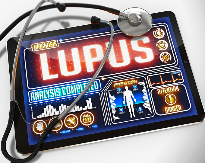 Системная красная волчанка у больных с перикардитом: применимость новых критериев EULAR/ACR