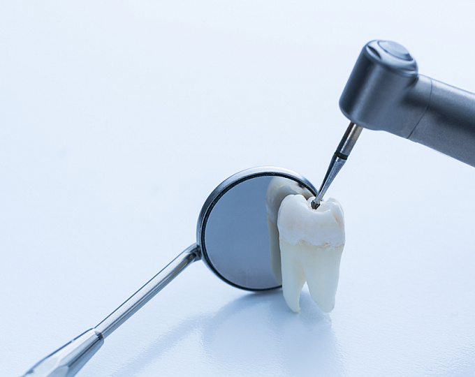 Пломбы, содержащие ртуть в стоматологии: последние новости FDA