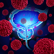 Риск развития рака предстательной железы у носителей мутаций в генах BRCA1 и BRCA2