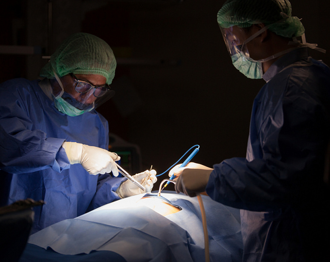 Необходима ли кишечная подготовка перед операцией гистерэктомией?