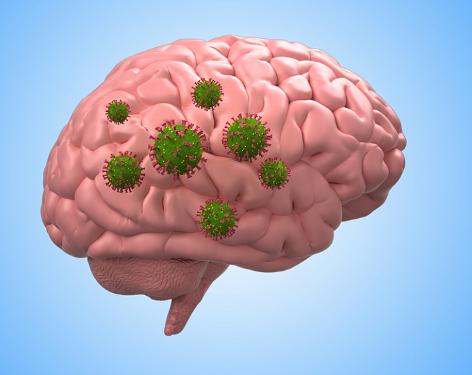 Нейропсихиатрические последствия коронавирусной инфекции