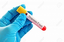 Высокочувствительный тропонин Т предопределяет 30-ти дневный прогноз у пациентов, подвергшихся некардиальным хирургическим вмешательствам 