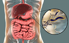 Связь между инфекцией Helicobacter pylori и синдромом раздраженного кишечника: систематический обзор и метаанализ
