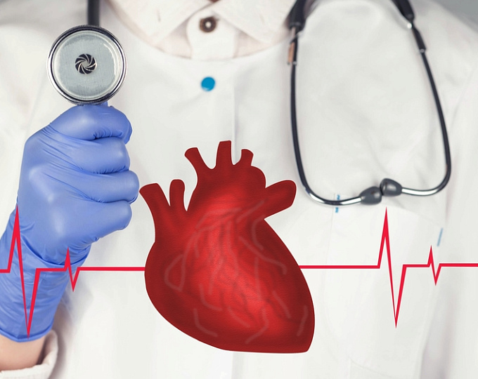 Сердечно-сосудистые осложнения лихорадки денге