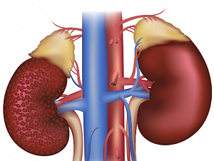  FDA зарегистрировало новое показание для назначения канаглифлозина – лечение диабетической нефропатии
