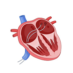 Эффективность и безопасность внутрисердечной эхокардиографии у пациентов с ФП: результаты мета-анализа