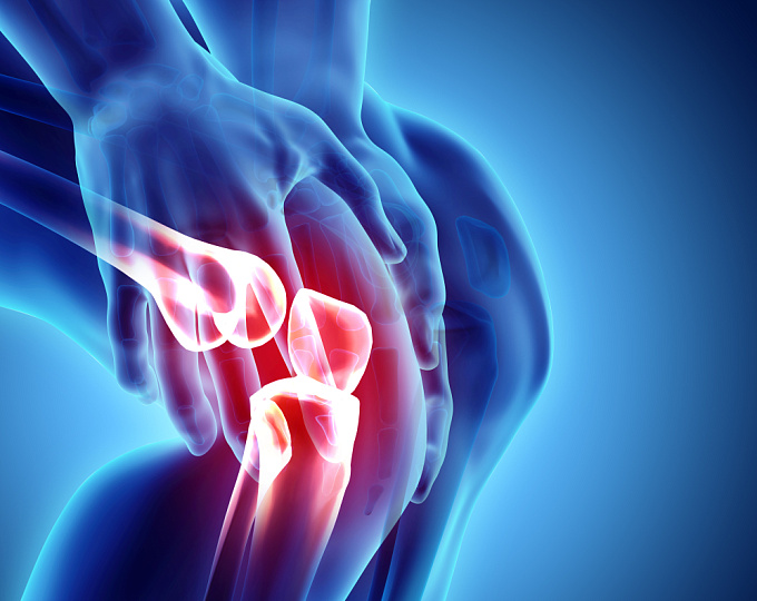 Может ли колхицин снизить необходимость протезирования суставов?