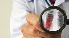Роль ультразвукового исследования легких в диагностике внебольничной пневмонии в условиях ОРИТ