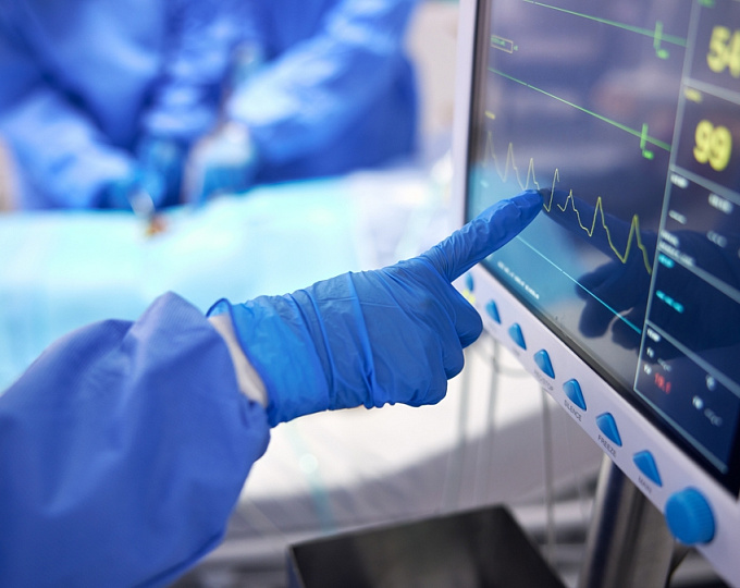 Объем левого желудочка и переносимость нагрузки у пациентов с ХСНсФВ