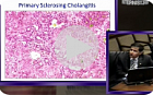 Intrahepatic cholestasis II: Approach to diagnosis and treatment.(eng)