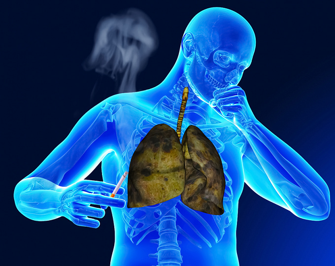 Может ли отказ от курения после диагностики рака легкого улучшить прогноз?