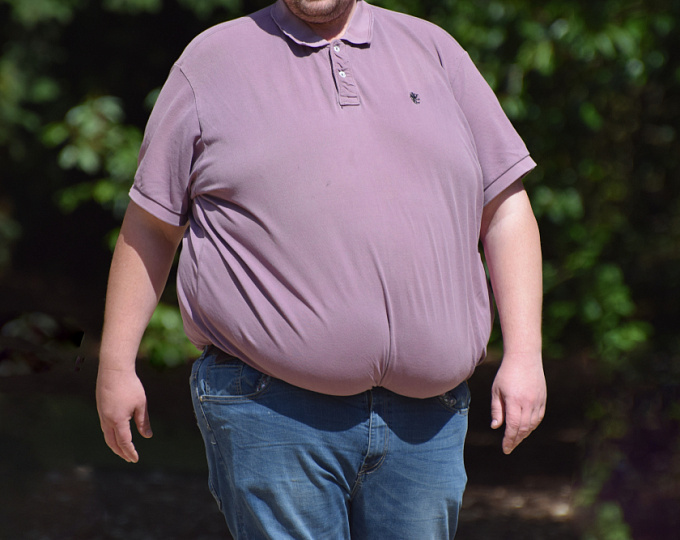 Семаглутид при ожирении: основные результаты исследования STEP 1