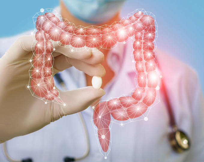 Виновны ли НПВП в обострении ВЗК?