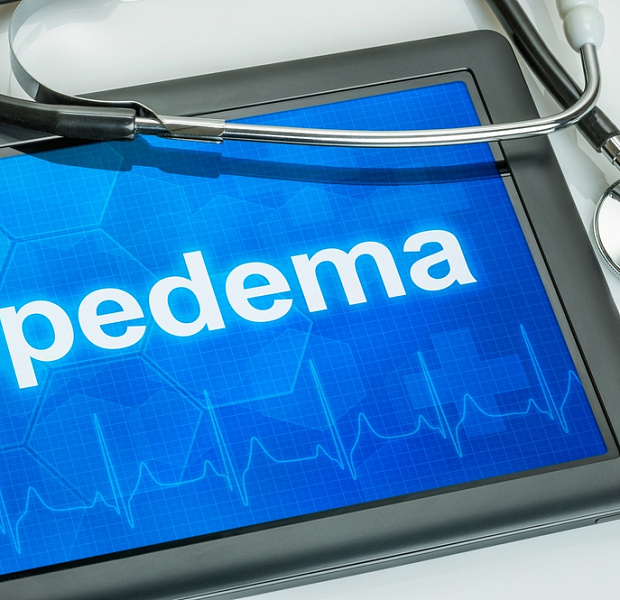 Сравнительная оценка эффективности сухой и влажной липосакции у пациентов с липедемой