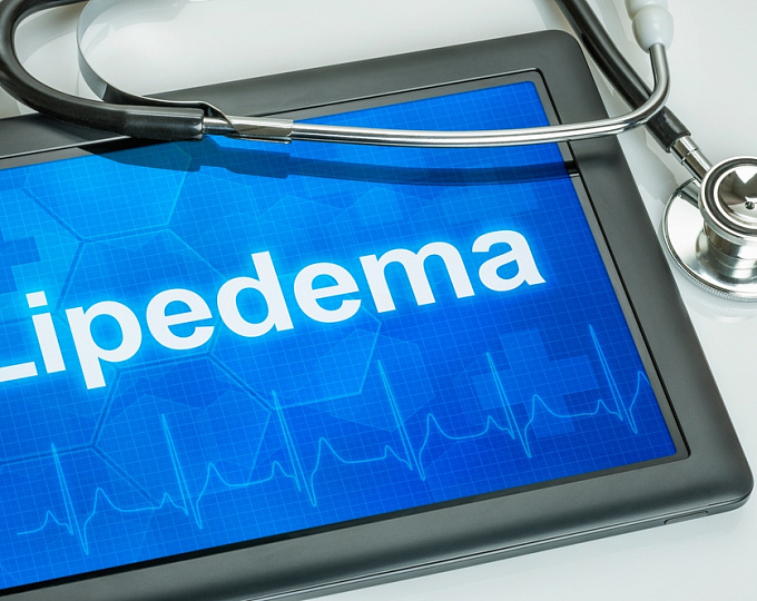 Сравнительная оценка эффективности сухой и влажной липосакции у пациентов с липедемой