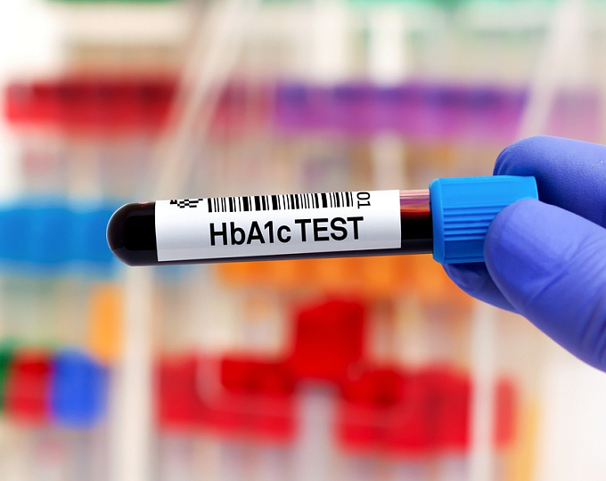 Ожидать ли повышения риска рака легкого у пациентов с предиабетом и диабетом?