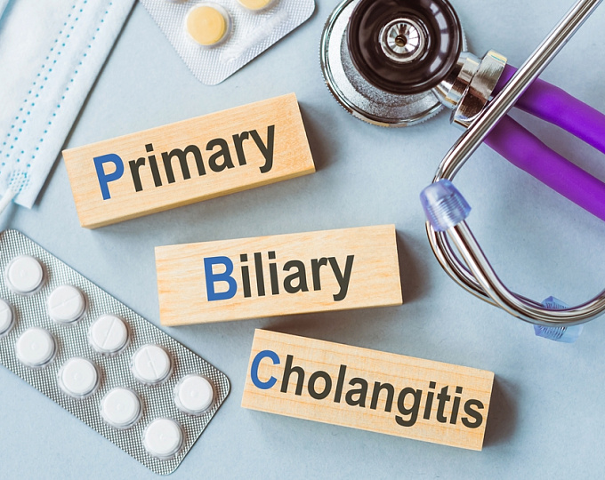 Риск колоректального рака у пациентов с воспалительным заболеванием кишечника и первичным склерозирующим холангитом