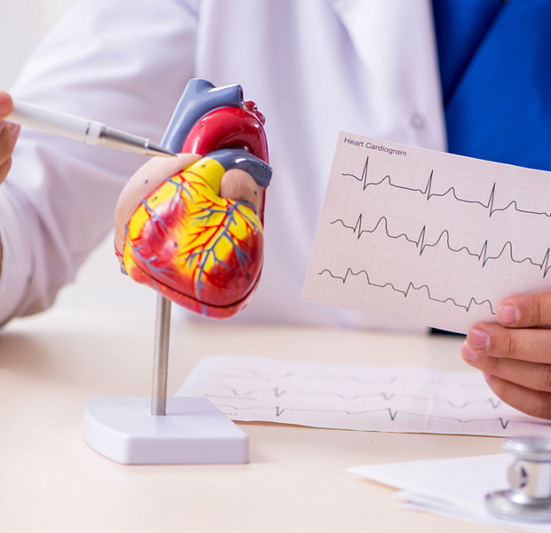 Инфаркт миокарда с подъемом сегмента ST: сравнение исходов фармакоинвазивной тактики и первичного ЧКВ