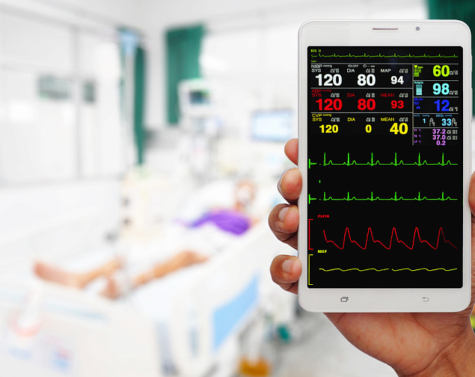 Влияет ли наличие ФП на успешность тромбэктомии при инсульте?