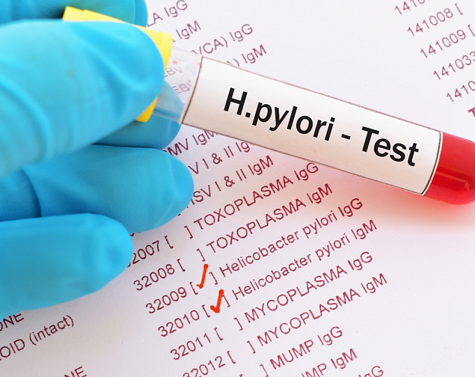 Глобальная распространенность Helicobacter pylori: что изменилось за последние 40 лет?