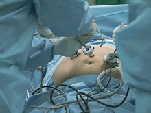 Роль метаболической бариатрической хирургии в улучшении метаболического контроля у пациентов с сахарным диабетом 1 типа