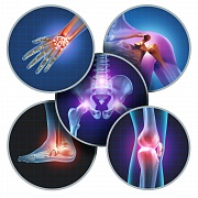 Скрининг и профилактика остеопоротических переломов. Результаты систематического обзора 