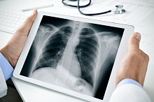 Не следует проводить радиографию грудной клетки для исключения острого аортального синдрома 