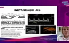 Мультипараметрическое ультразвуковое исследование в ранней диагностике атеросклероза. Взгляд врача ультразвуковой диагностики