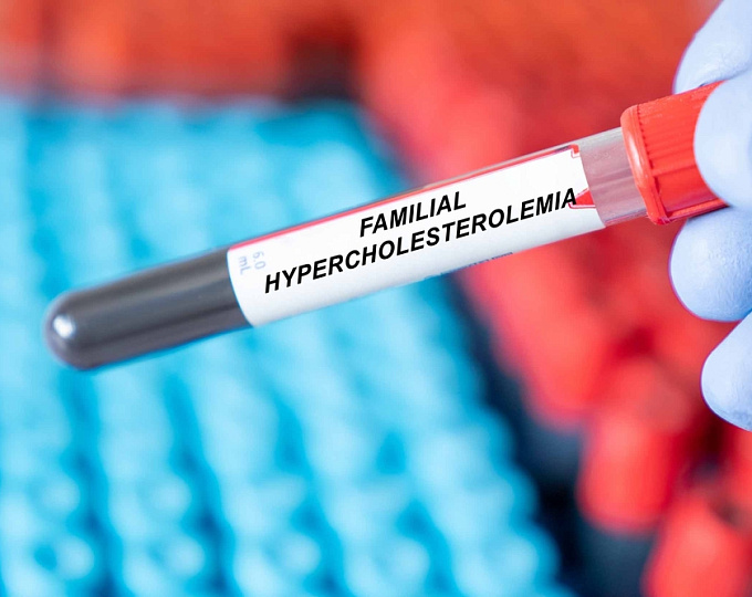 Эффективность ингибиторов PCSK9 в снижении ХС-ЛПНП у пациентов с семейной гиперхолестеринемией