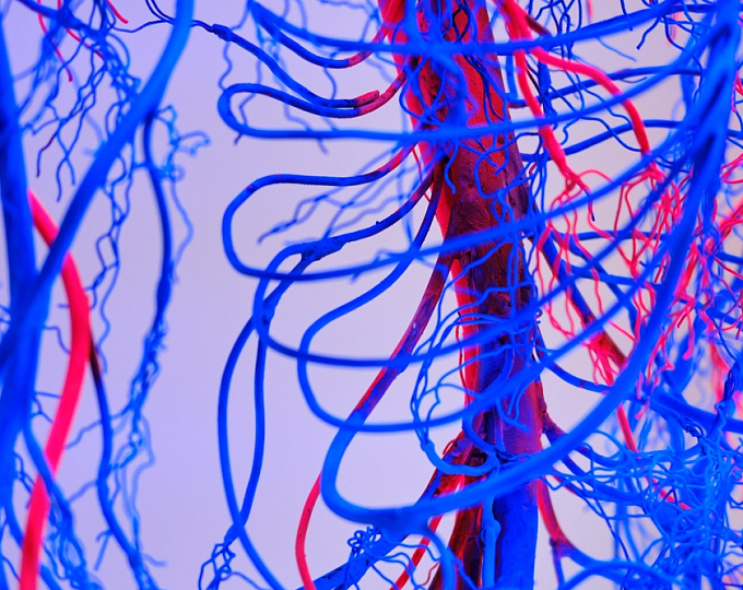 Прогностическое значение уровня д-димера у пациентов с диссекцией аорты