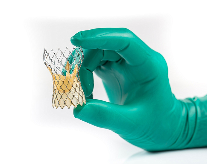 TAVI у пациентов с двустворчатым аортальным клапаном: исходы в зависимости от пола пациентов