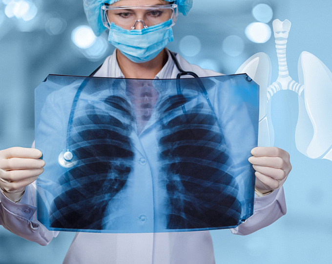 Как связаны выраженность обструкции дыхательных путей и качество жизни пациентов с ХОБЛ?