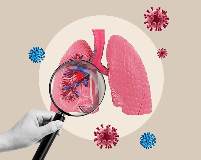 Как перенесенный туберкулез влияет на функцию легких?